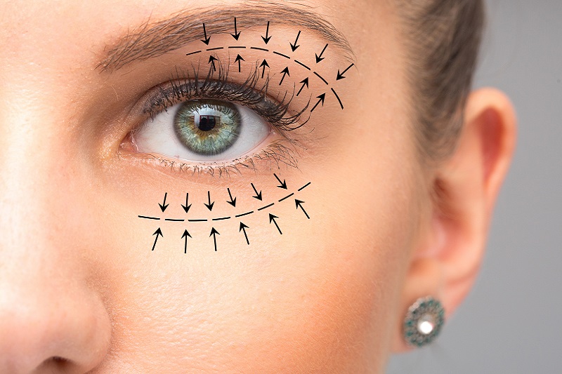 Jak poradzić sobie z opadającą powieką?