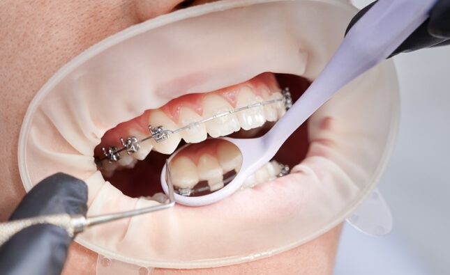 Jak wybrać odpowiedniego ortodontę?